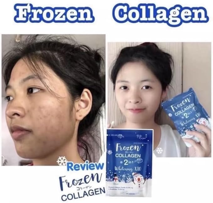 Frozen Collagen