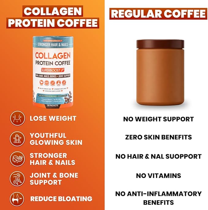 Collagen Peptides Coffee Powder for Weight Loss – Supports Digestion Bloating Energy &amp Focus Fat Burning Joint Skin Hair &amp Nails – High-Protein for Women &amp Men (30 Servings)