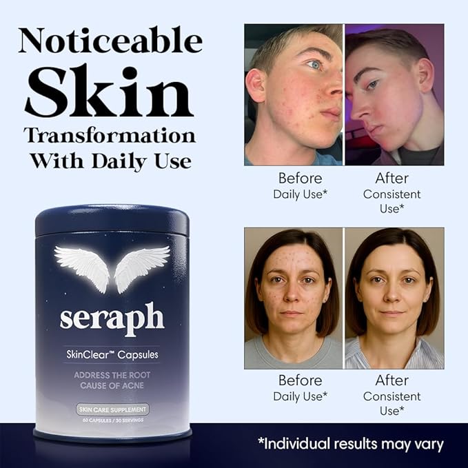 Seraph Acne Supplement - Hormonal Acne Pills Treatment - Pimple Supplements for Women - Skin Clear Capsules for Teen Men &amp Adults - Made in USA - 60 Tablets