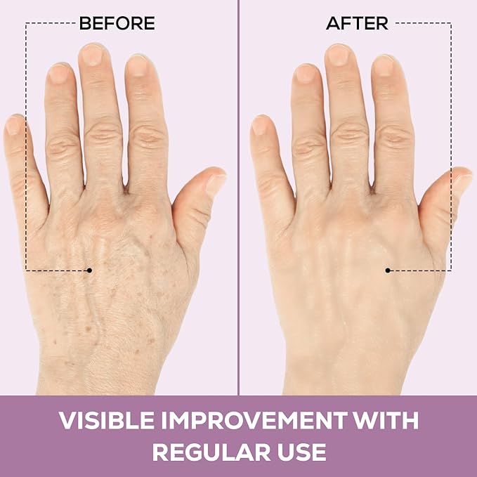 Kami Pure Silicone Hand Wrinkle Patches Anti-Aging Collagen Filler Pads Hydrate Plump &amp Smooth Skin Reusable Single Pack