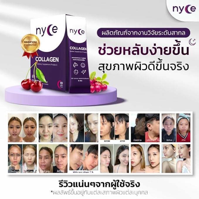 Nyce Collagen 10000mg