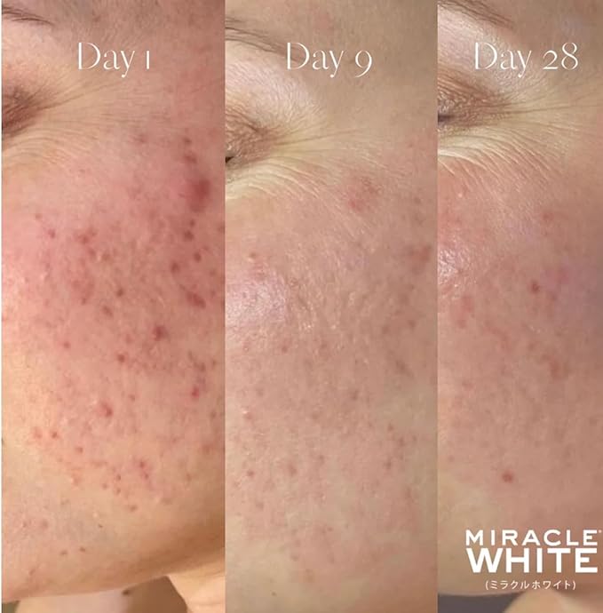 Miracle White Beauty Glow