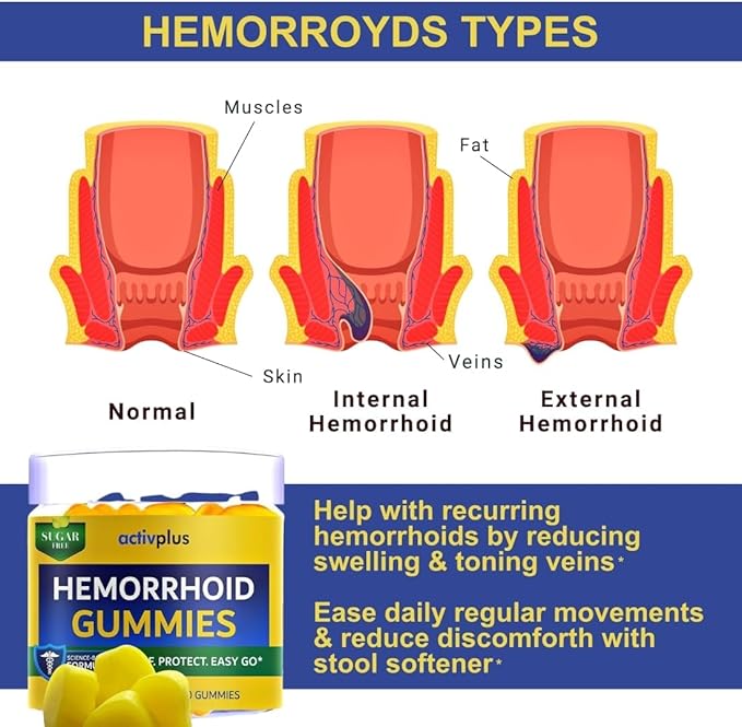 Hemorrhoid Treatment to Reduce Re-occurrences &amp Easier Regularity with Stool Softener | 7 Clinically Studied hemorrhoid Ingredients | Plant-Based Sugar Free Lemon 60 Vegan Gummies
