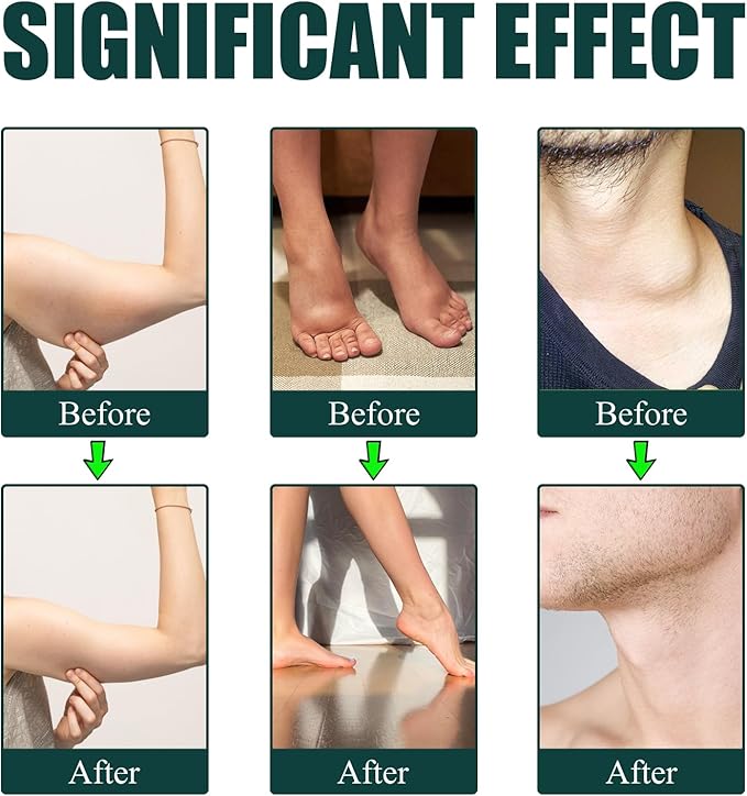 Lymphatic Drainage Drops Lymphatic Support Liquid Drops with Herbal Ingedients Reduce Bloating Full Body Detox &amp Cleanse Promote Circulation Vegan Non-GMO (60ml) (1)