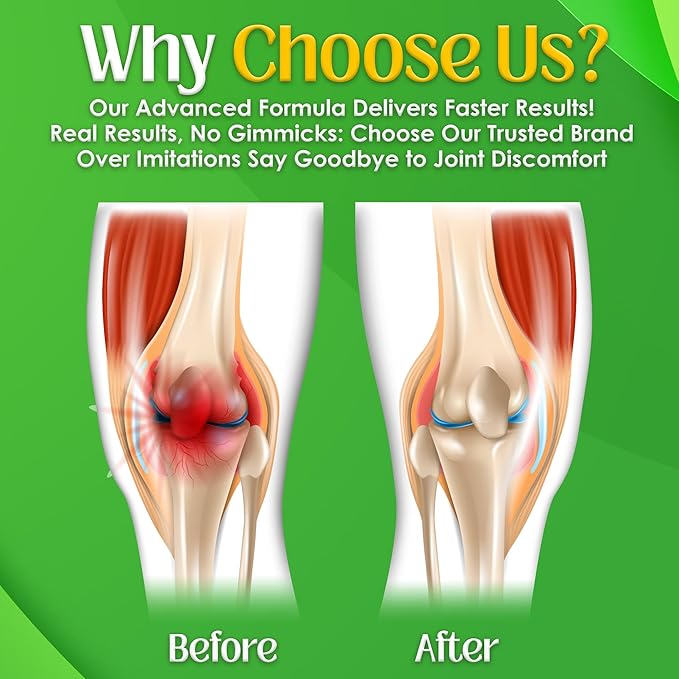 NutriGout Uric Acid Cleanse Supplement w/Turmeric Celery Seed Bromelain Milk Thistle Dandelion and Chanca Piedra 60 Vegetarian Capsules of 500 mg Each