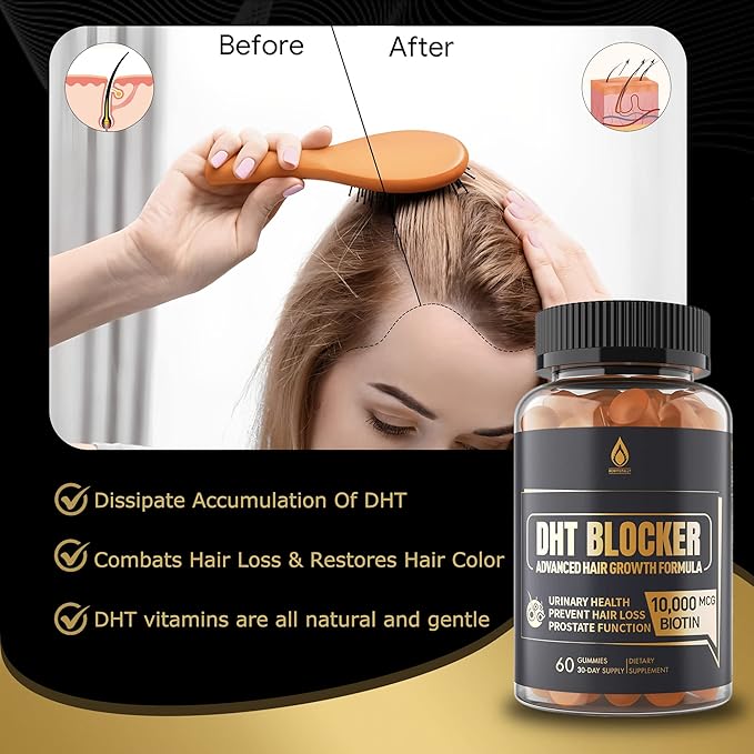 DHT Blocker Gummies Hair Growth Supplement Super Potency Saw Palmetto &amp Biotin 10000 mcg for Women &amp Men Plus 12 Proprietary Blend - Prevent Hair Loss Blocking DHT Receptors 2Pc/120ct