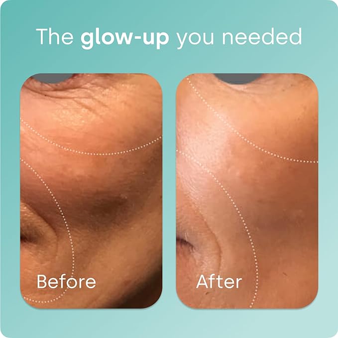 Biosil Collagen Booster Supplement - 120 Original Capsules - Patented ch-OSA Activator for Skin Hair Nails &amp Joints - Supports Natural Production - 60-Day Supply