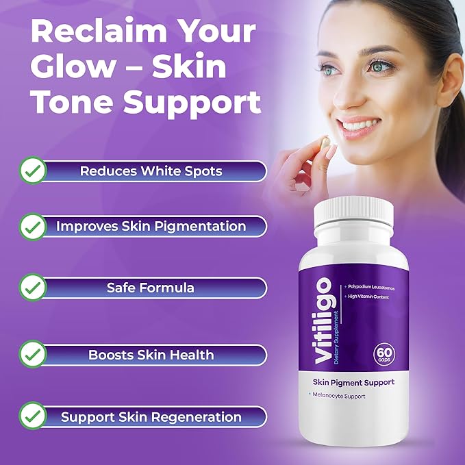 Vitiligo Capsules 60 Count | 1 Month | Improve Skin Pigmentation Support and Reduce White Spots | Effective Vitiligo Supplement | Natural Solution for White Spots on Skin. (2)