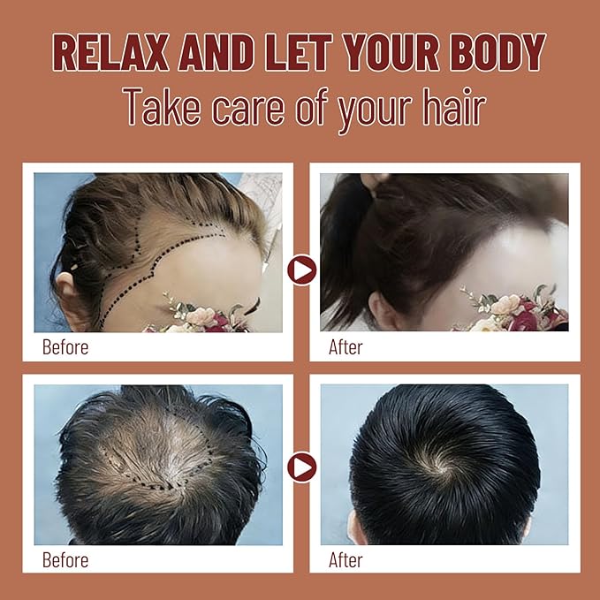 Hair Growth Tea More Hair Inside Out for Healthy Follicle Regrowth 30 Tea Bags