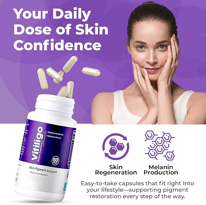 Vitiligo Capsules 60 Count | 1 Month | Improve Skin Pigmentation Support and Reduce White Spots | Effective Vitiligo Supplement | Natural Solution for White Spots on Skin. (3)