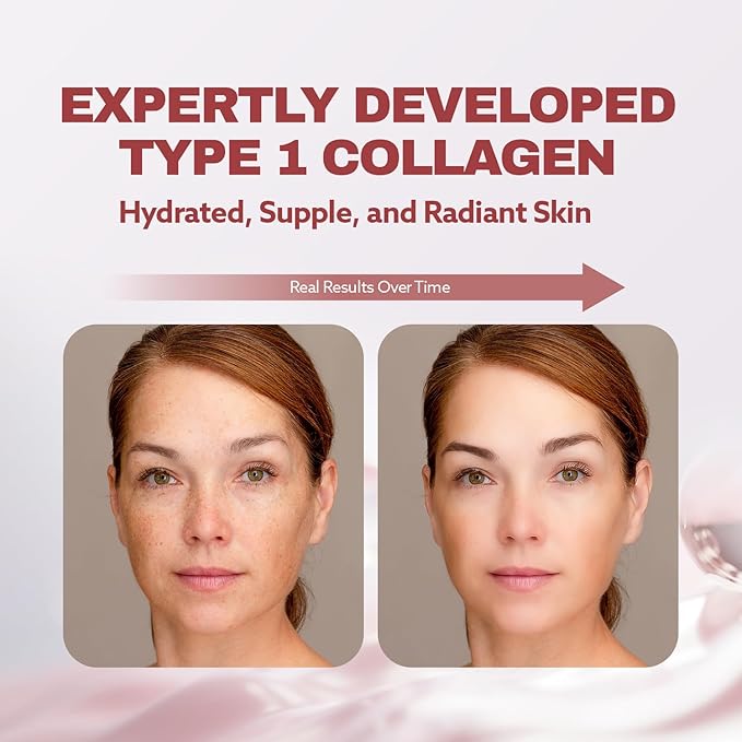 ILO Type 1 Liquid Collagen Drink – 3000mg Marine Collagen with Biotin &amp Ceramide | Skin Glow &amp Hydration | Orange Flavor | 14 Bottles – Korean Beauty Supplement