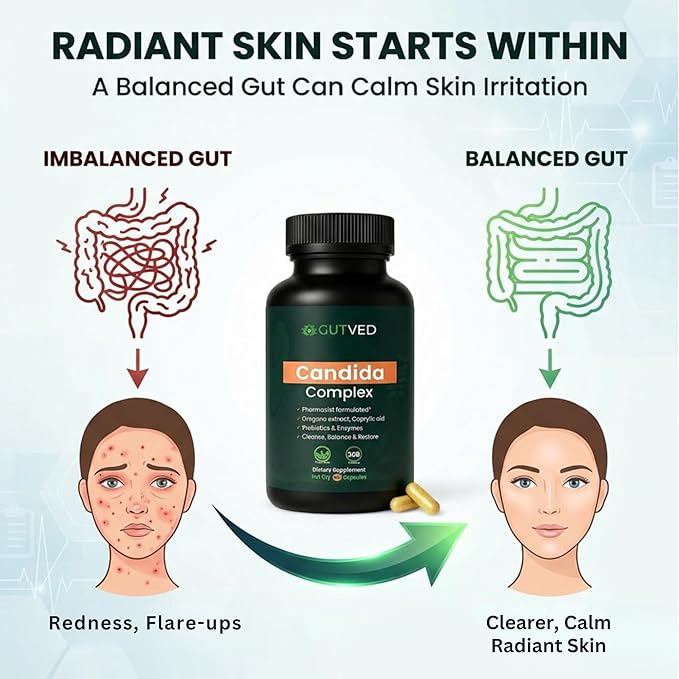 Candida Complex with Caprylic Acid for Men &amp Women – Anti Overgrowth Balance and Restore Supplement for Yeast Healthy Gut Flora &amp Skin with 30B/g Probiotic Oregano Senna - 1 Month Supply