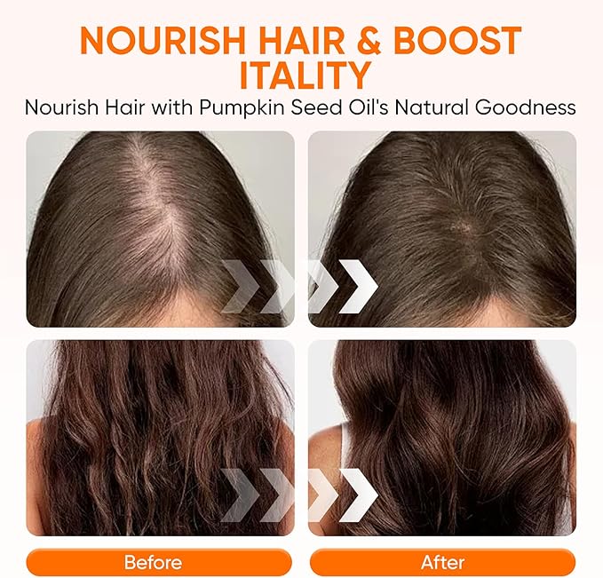 Pumpkin Seed Oil Capsules 2 in 1 Pumpkin Seed Oil with Saw Palmetto for Hair 3000mg Pure &amp Natural Supplement Supports Hair Heart Skin Supplement Non-GMO Gluten Free 300 Softgels (1)