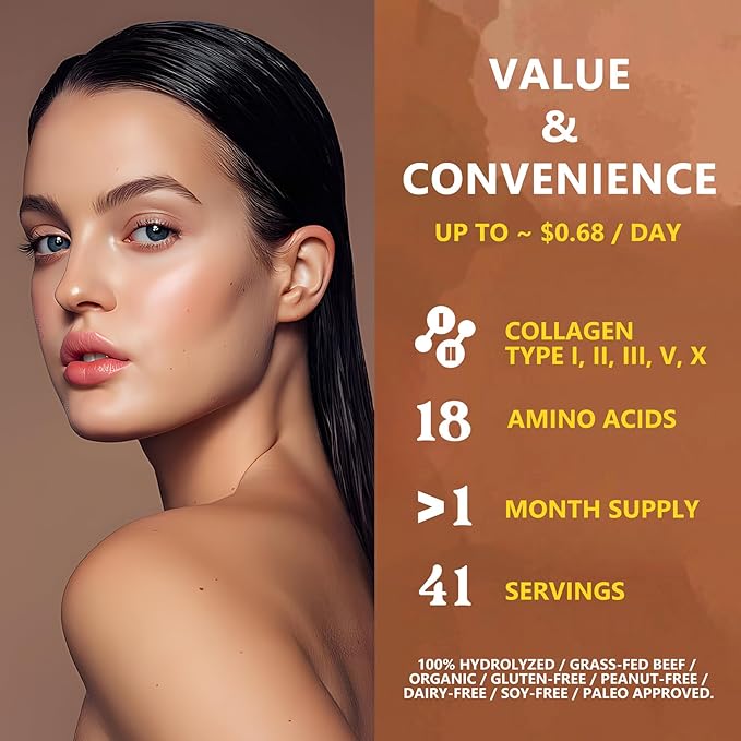 Zammex Multi Collagen Protein Powder Type I &amp III &amp V &amp X Hydrolyzed Collagen Peptides for Women &amp Men Supports Hair and Skin Gut Health 41 Servings Chocolate