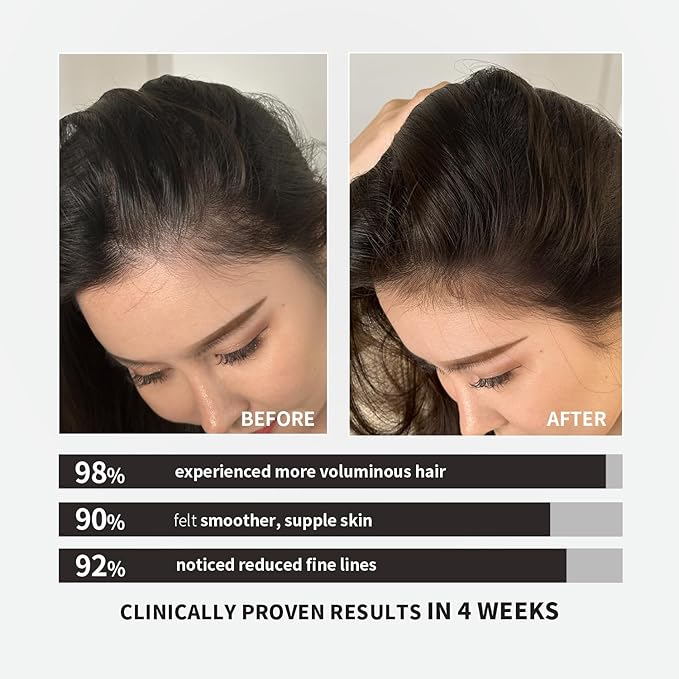 Voluminous Fortifying Collagen Peptides Protein–6500mg Dual-Patented Collagen Powder&amp8 Key Nutrients|Supports Growth HairStrong NailsHealthy Skin.Highly PureNo EstrogenNo Hormones-3.53 oz