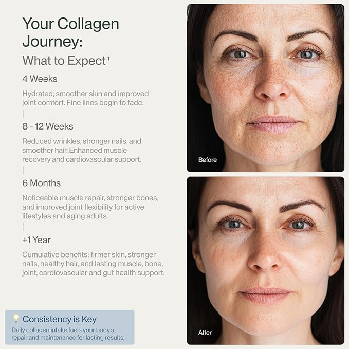 Collagen Peptides Powder Grass-Fed Pasture-Raised Hydrolyzed Collagen Powder Type I &amp III Hair Nails Skin and Joints Non-GMO Paleo &amp Keto Unflavored 16 Fl oz. 45 Servings