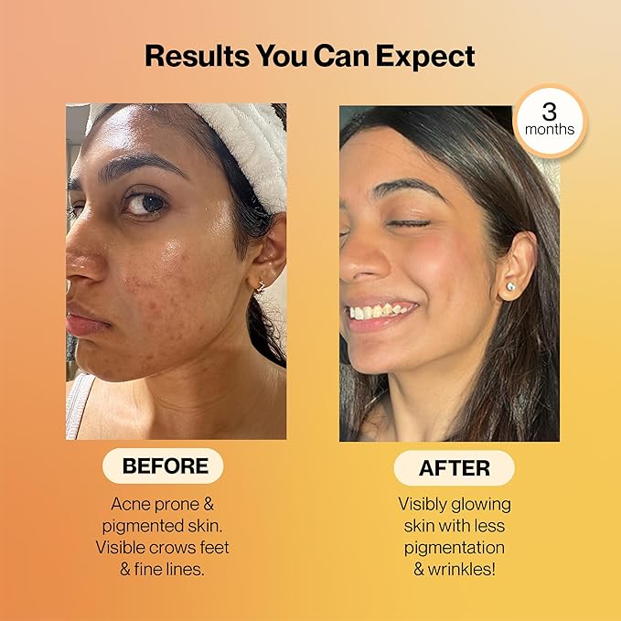 SETU Radiant Skin: Combo Contains 8g Marine Collagen + Ceramosides &amp 8-in-1 Glutathione Fizzy Tabs | Supports Radiant Healthy Skin | for Men &amp Women
