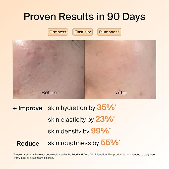 Ownist Triple Collagen Liquid Packets On-The-Go - Peptides with Hydrolyzed Marine Collagen Elastin Hyaluronic Acid and Vitamin for Healthy Skin - Orange Flavor - 84 Individual Stick Packs (6 Boxes)