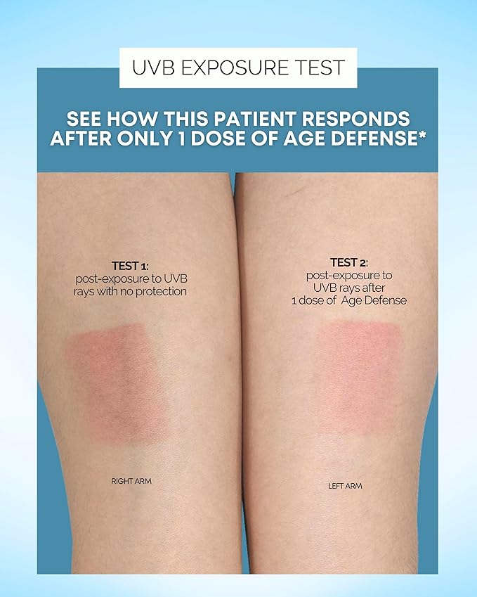 Age Defense Vitamins - Dermatologist and Plastic Surgeon Developed to Fight photoaging and Melasma Polypodium Leucotomos Antioxidant Formula – Vegan Gluten-Free – 60 Capsules