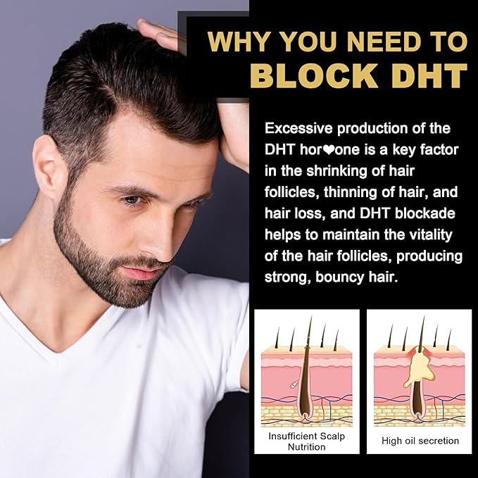DHT Blocker Gummies Hair Growth Supplement Super Potency Saw Palmetto &amp Biotin 10000 mcg for Women &amp Men Plus 12 Proprietary Blend - Prevent Hair Loss Blocking DHT Receptors Hormonal Balan
