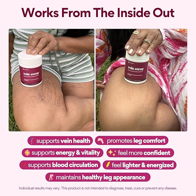 VoomVaya Vein Away – Blood Circulation &amp Vein Support Supplements for Women 35+ | Spider Veins &amp Varicose Veins Treatment for Legs | Circulation and Vein Support w/Diosmin &amp Hesperidin | 6