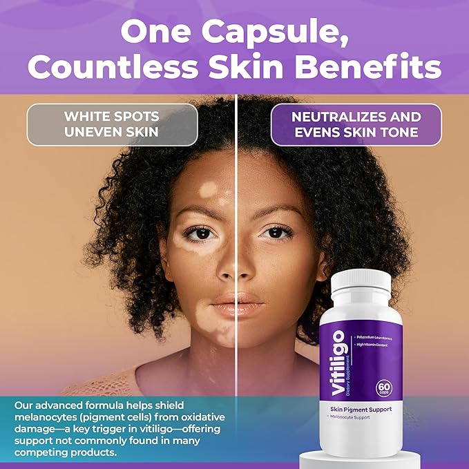 Vitiligo Capsules 60 Count | 1 Month | Improve Skin Pigmentation Support and Reduce White Spots | Effective Vitiligo Supplement | Natural Solution for White Spots on Skin. (3)
