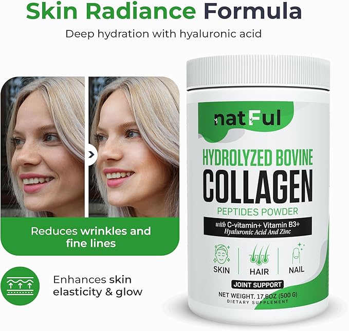 Collagen Peptides Powder – Hydrolyzed Bovine Collagen with Vitamin C Hyaluronic Acid Zinc &amp B3 – Type 1 &amp 3 Unflavored Protein Powder for Women &amp Men Hair Skin Nails Joints 45 Serving