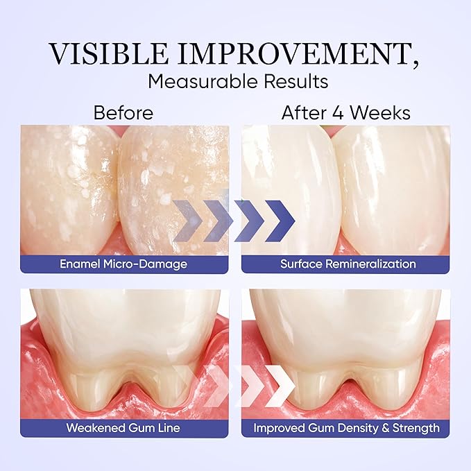 Nudent Collagen Powder Nano-Hydroxyapatite Teeth Powder Smile Strengthening Collagen Strengthens Gums &amp Enamel Gentle Formula for Gums Improve Overall Gum Strength 50g (1)