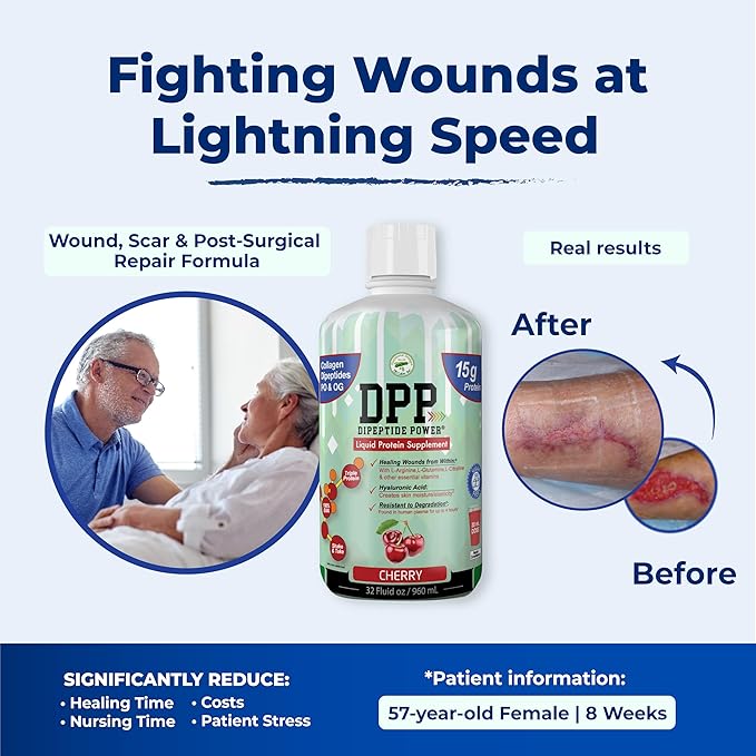 DPP Dipeptide Power Wound-Healing 30X More Collagen Dipeptides Than Powder Liquid Protein Supplement Sugar-Free Supports Healthy Tissue Repair Foot Ulcers Cosmetic Surgery (Cherry 32 Fl Oz)
