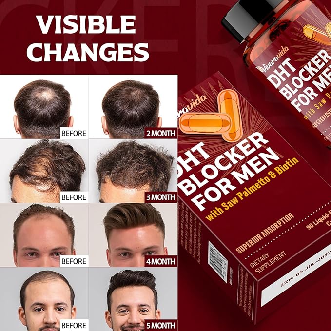 DHT Blocker for Men | Hair Growth Vitamins Supplement with Saw Palmetto &amp Biotin - Hair Regrowth - Natural Hair Loss Supplements Liquid-Filled - Proprietary Herbal Blends (180 Capsules)