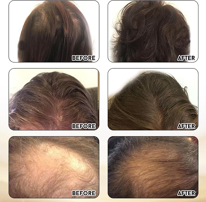 Joyce Giraud Ultimate Hair Strength Supplements 60-Day Supply Scientifically Formulated to Reduce Hair Loss 120 Capsules