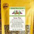 ACNE TEA – Organic Herbal Blend to Support Clear Skin &amp Complexion – Formulated by Master Herbalist Khabir – 100% Organic Non-GMO No Additives