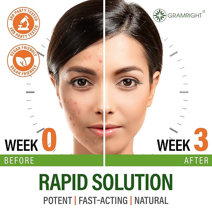 Perfect Skin Acne Pills - Clear Skin Supplement with Niacinamide Probiotic Zinc &amp Vitamin A - Anti Acne Vitamins for Teens Men &amp Women - Support for Face &amp Back Acne Acne Scars - 60 Ca