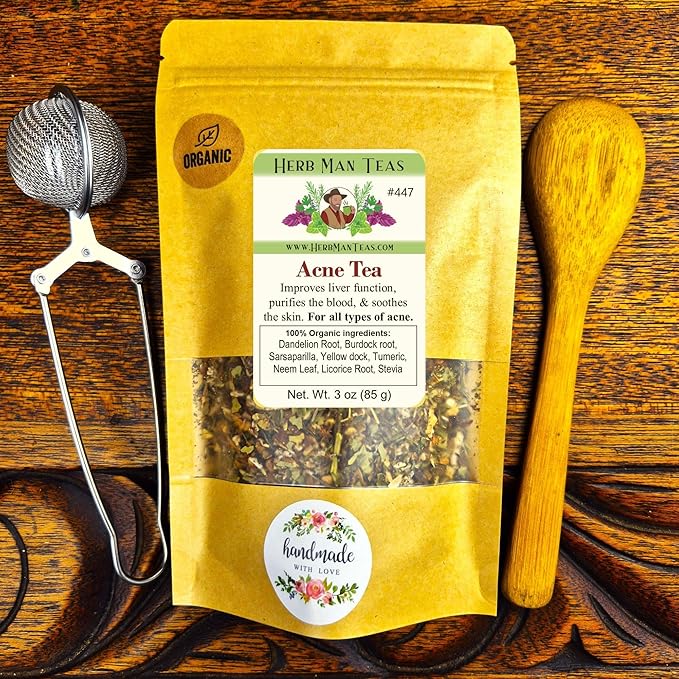 ACNE TEA – Organic Herbal Blend to Support Clear Skin &amp Complexion – Formulated by Master Herbalist Khabir – 100% Organic Non-GMO No Additives